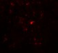 RBBP8 Antibody